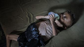 Sözün bittiği nokta Gazze açlıktan ölüyor