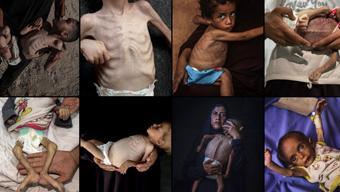 Gazze açlıktan ölüyor Kıtlık sebebi ile can verenlerin sayısı 281’e yükseldi