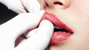 Dolgu ve Botoksun Karanlık Yüzü: 100 Kişide Ortak Sonuç: Damarlardaki Kan Akışını Durduruyor Yan Etkileri Korkunç