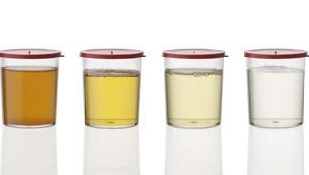 İdrar Rengi Böyleyse Dikkat