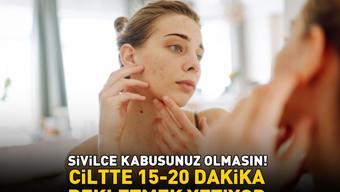SİVİLCELERİN KÖKÜNÜ KURUTAN YÖNTEM Doğal antiseptik ve nemlendirici Ciltte 15–20 dakika bekletmek yetiyor