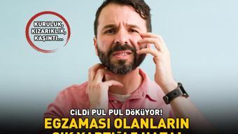 EGZAMASI OLANLARIN SIK YAPTIĞI 5 HATA Cildi pul pul döküyor; kuruluk, kızarıklık ve kaşıntıya neden oluyor