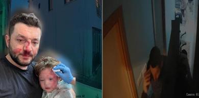 14-aylik-ikranin-kafatasi-catlamisti-turkiyenin-konustugu-olayin-goruntuleri-ortaya-cikti