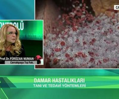 Aort yırtıklarında tanı hangi yöntemle yapılıyor