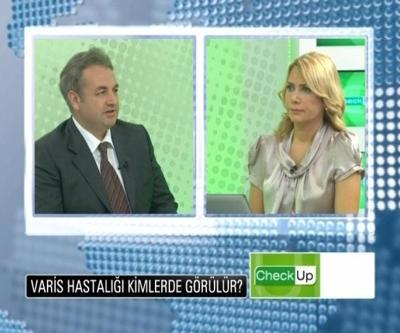 Varis hastalığı ne gibi şikayetlere sebep olur
