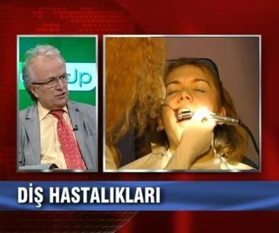 Diş taşları düzenli olarak aldırılmalı mıdır