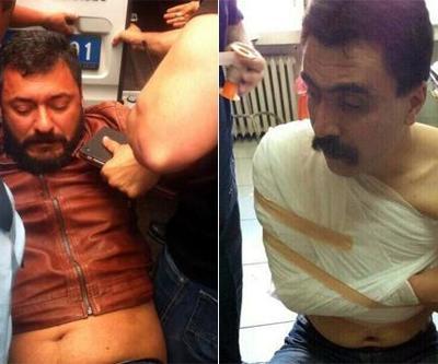 Kolu kırılan ÇHD Başkanı Selçuk Kozağaçlı yaşadıklarını anlattı
