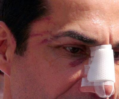 CHPli Hüseyin Sağa saldırıda iki gözaltı