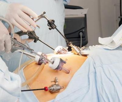 Obezite cerrahisinde nasıl ameliyatlar mevcuttur