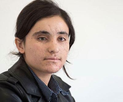 DEAŞın elinden kurtuldu: Tek ayağımı keserseniz ötekiyle yine kaçarım