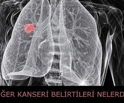Akciğer kanseri nedir Belirtileri nelerdir