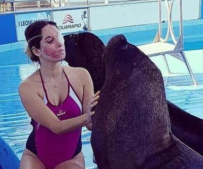 Asit saldırısına uğrayan model yaşama tutunmaya çalışıyor