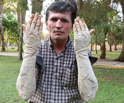 Onu gören korkuyordu... Musa Sümbülün son hali şaşırtıyor