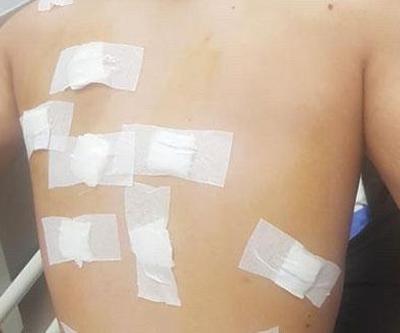 Kaybolan koyununu ararken avcıların hedefi oldu