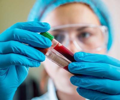Kök hücre transplantasyon tedavisi nedir