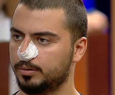 MasterChef Serhatın burnuna ne oldu