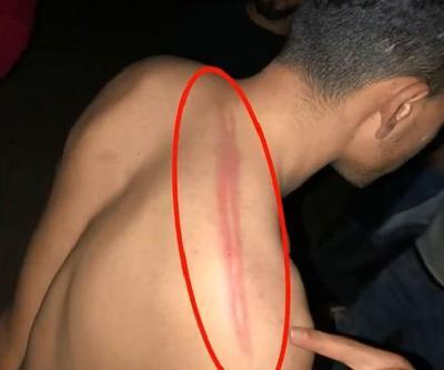 Yunan askerlerinin ölüme terk etti, Mehmetçik kurtardı