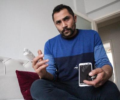 Bomba gibi patlayan powerbank parmağını kopardı