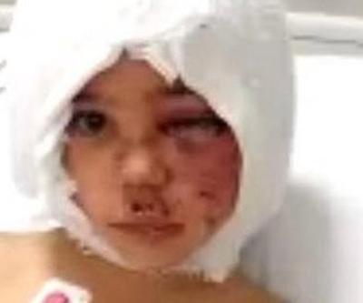 Pitbull saldırısına uğrayan Asiyenin son durumu nasıl