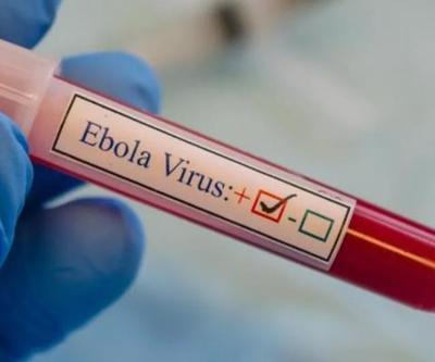 Uganda’daki Ebola salgınında can kaybı 29’a yükseldi
