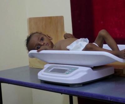 Yemende açlık krizi