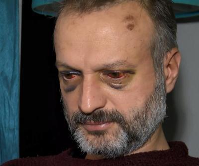‘Çiftetelli’ çalmadığı için dövülen müzisyen: Çalışamayacak durumdayım, çok mağdurum