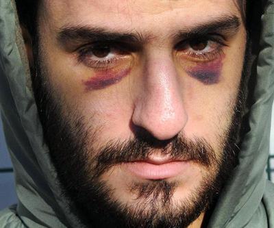 Göçmenlere yine Yunan zulmü: O kadar çok dövdüler ki bayıldım