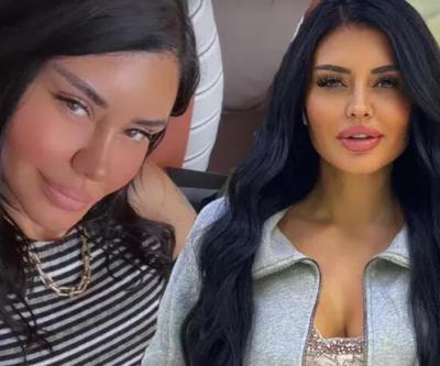 Ebru Polat yaptırdığı estetikleri saydı