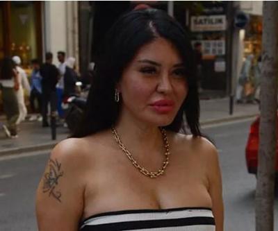Ebru Polat estetik sorularını cevapladı