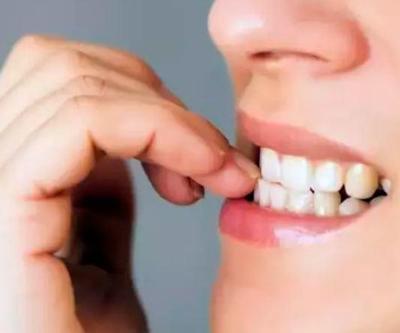 Tırnak yeme alışkanlığı nasıl bırakılır