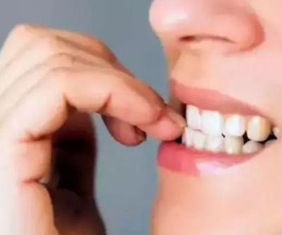 Tırnak yeme alışkanlığı nasıl bırakılır