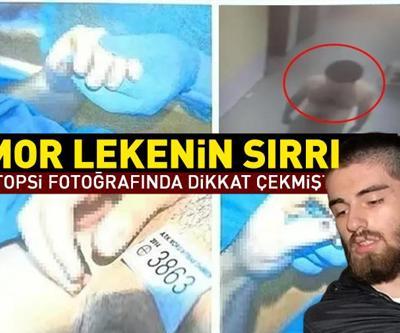 SON DAKİKA Cem Garipoğlunun otopsi fotoğrafında dikkat çekmişti Mor lekenin sırrı ne
