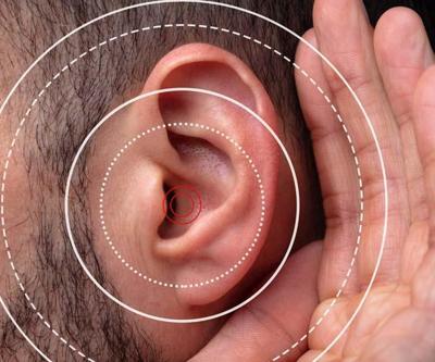 Kulak çınlaması neyin habercisi Bu alışkanlıklar kulak çınlamasını daha da kötüleştiriyor
