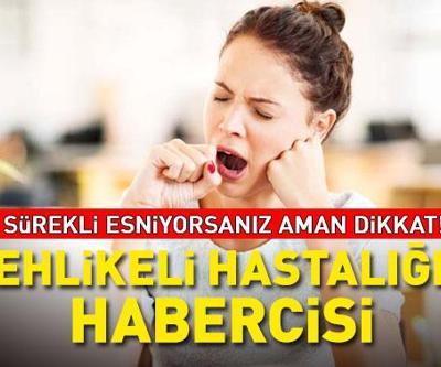 Evde, işte, arabada... Sürekli esniyorsanız aman dikkat Meğer bu tehlikeli hastalığın habercisiymiş