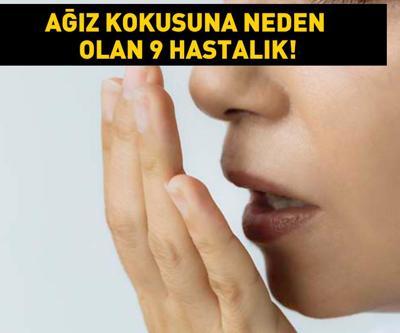 Geçmeyen ağız kokusunun nedeni bu hastalıklar olabilir Karaciğer yetmezliğinden diyabete... İşte o 9 hastalık