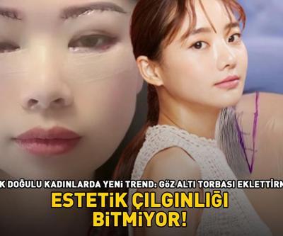 Estetik çılgınlığı bitmiyor Uzak Doğulu kadınların yeni gözdesi: Göz altı torbası eklettirme