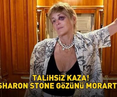 Bodrum’da talihsiz kaza Temel İçgüdünün yıldızı Sharon Stone gözünü morarttı