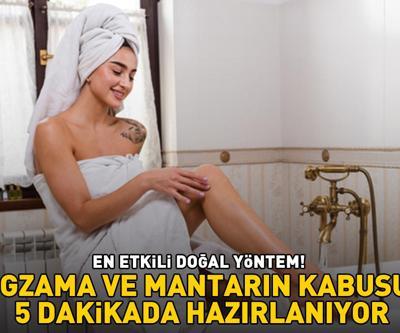 EGZAMA VE MANTARIN KABUSU 5 dakikada hazırlanıyor: Nasır, kaşıntı ve egzamaya iyi geliyor; mantarın kökünü kurutuyor