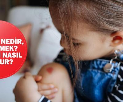Narin otopsi sonucunda lezyon detayı Lezyon nedir, ne demek Lezyon nasıl oluşur