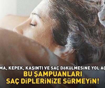AMAN DİKKAT BU ŞAMPUANLARI SAKIN KULLANMAYIN Egzama, kepek, kaşıntı ve saç dökülmesi sorununa yol açıyor