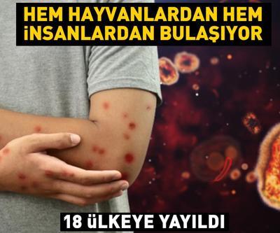 18 ülkeye yayıldı Hem hayvanlardan hem insanlardan bulaşıyor