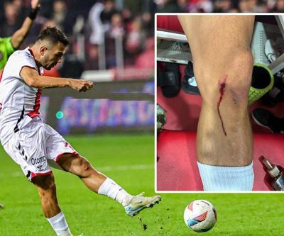Samsunspor, penaltı tepkisini böyle gösterdi Emre Kılınçın dizini paylaştılar...