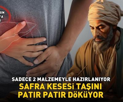 İbn-i Sinanın asırlık şifa reçetesi Safra kesesi taşını patır patır döküyor SADECE 2 MALZEMEYLE HAZIRLANIYOR