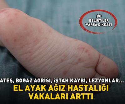 EL AYAK AĞIZ HASTALIĞI VAKALARI ARTTI, HASTANELER DOLDU TAŞTI Ateş, boğaz ağrısı, iştah kaybı, lezyonlar... Bu belirtiler varsa dikkat