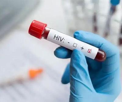 İzmir’de 13 yaşındaki çocuk AIDS’ten öldü Uzmanlardan şoke eden uyarılar: 15-19 yaşta HIV alarmı...