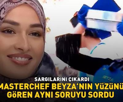 YÜZÜ YANMIŞTI MasterChef Beyza sargılarını çıkarınca herkes şoke oldu: EN UFAK YARA İZİ YOK