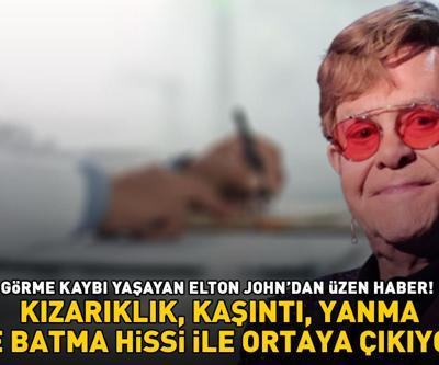 Elton Johndan üzen haber: Şarkı sözlerini bile okuyamıyorum Kızarıklık, kaşıntı batma ve yanma hissi ile ortaya çıkıyor