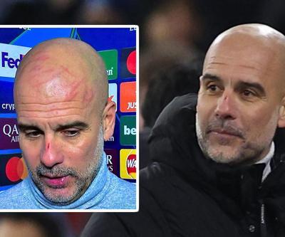 Saçı yok ama başını yoldu Pep Guardiola, Feyenoorda 3-0dan puan verdikten sonra çılgına döndü...
