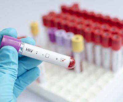 Erken Teşhis ile HIV enfeksiyonu kontrol altında alınabiliyor