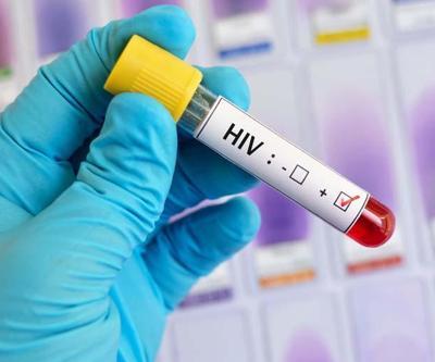 AIDS şüphesine test önerisi Bu belirtiler önemsenmiyor ama...